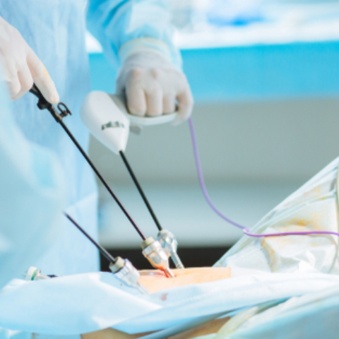 Laparoscopic Surgery Hospital in Kelambakkam